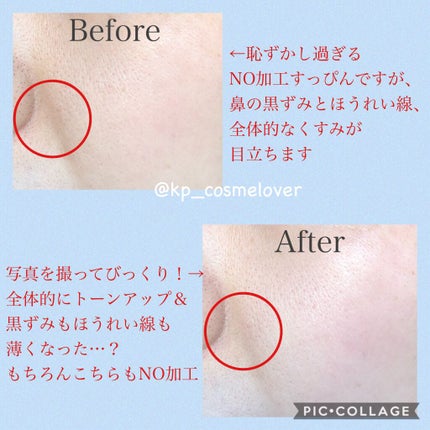 PLUMINUS/mous./美顔器・マッサージを使ったクチコミ(8枚目)