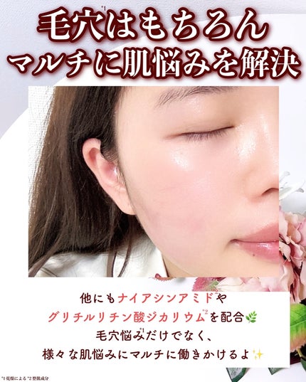 バブバブ ナノバブルオイルローション/Bab2/化粧水を使ったクチコミ(5枚目)