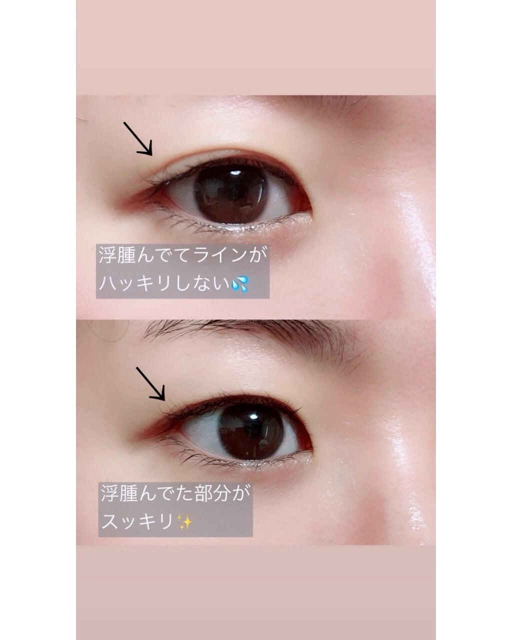 ダブルアイリキッド/Automatic Beauty/二重まぶた用アイテムを使ったクチコミ(5枚目)