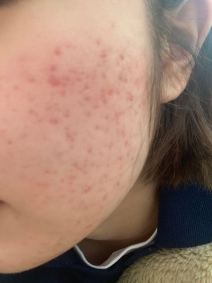 を使ったクチコミ(2枚目)