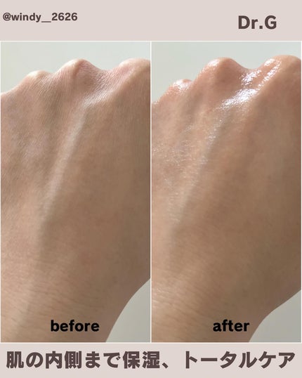 ブラックスネイル クリーム/Dr.G/フェイスクリームを使ったクチコミ(4枚目)