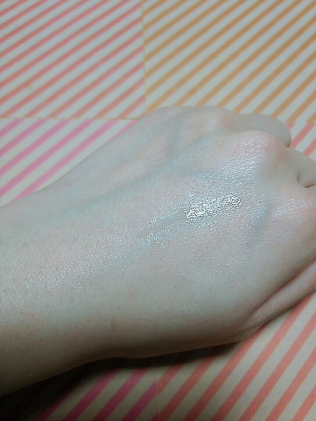 モアリップ N (医薬品)/資生堂薬品/その他を使ったクチコミ(2枚目)