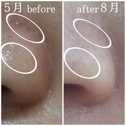 ウォッシャブル コールド クリーム/ちふれ/クレンジングクリームを使ったクチコミ(3枚目)