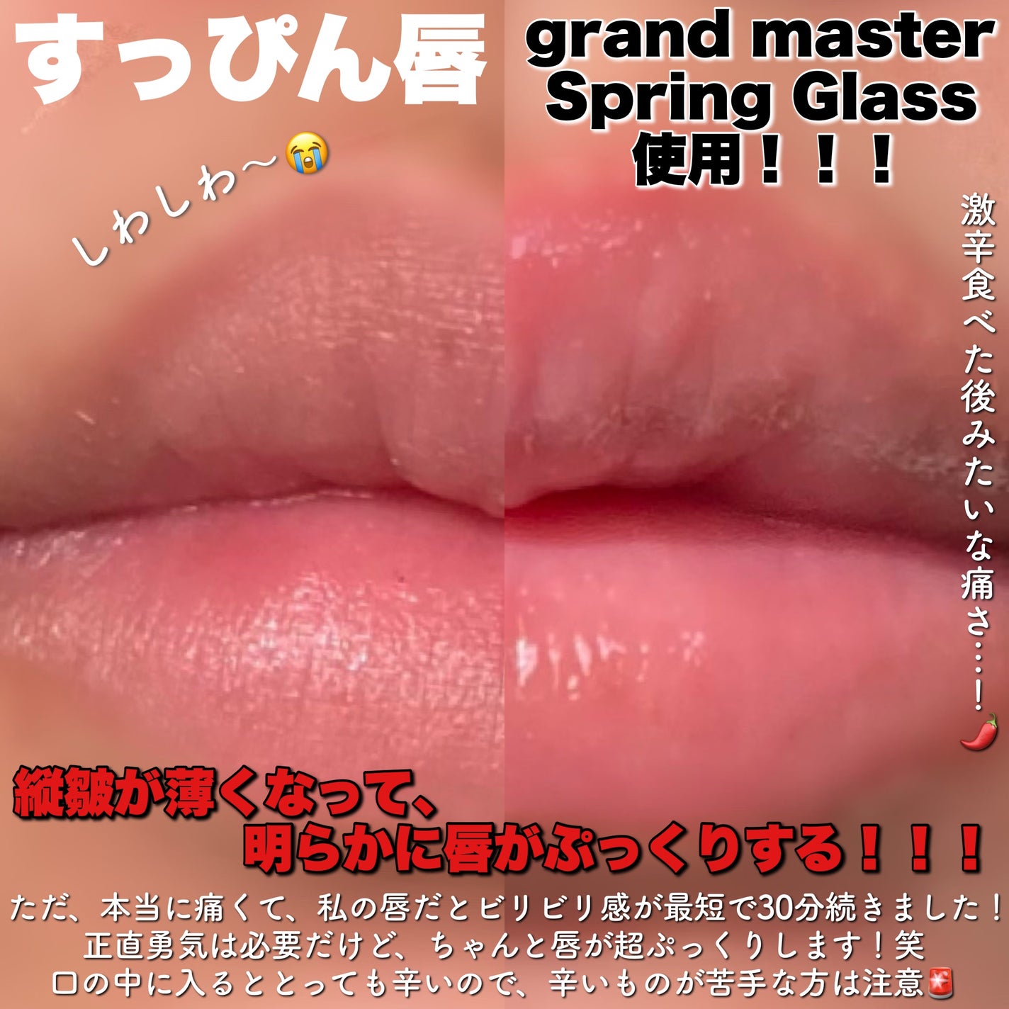 ドトムリッププラスプランパー/keybo/リッププランパーを使ったクチコミ(4枚目)