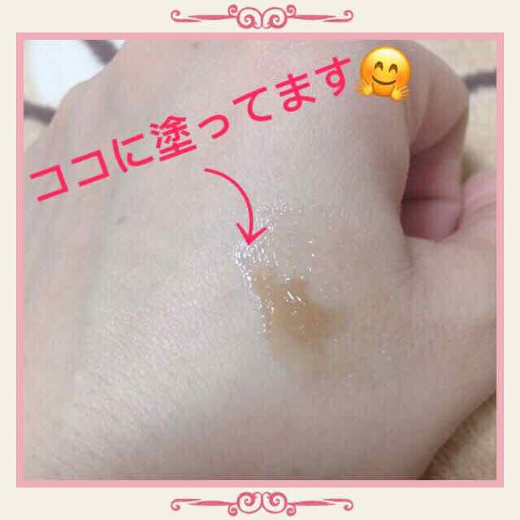 リップピーリング/トレンドホリック/リップスクラブを使ったクチコミ（3枚目）