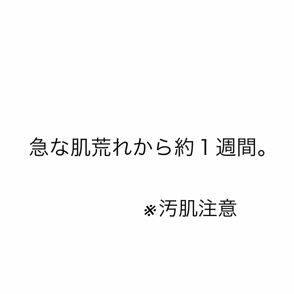 ドルマイシン軟膏(医薬品)/ゼリア新薬工業/その他を使ったクチコミ（1枚目）