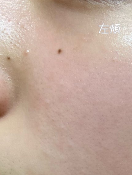 薬用しみ対策 美白化粧水 しっとりタイプ/メラノCC/化粧水を使ったクチコミ(4枚目)