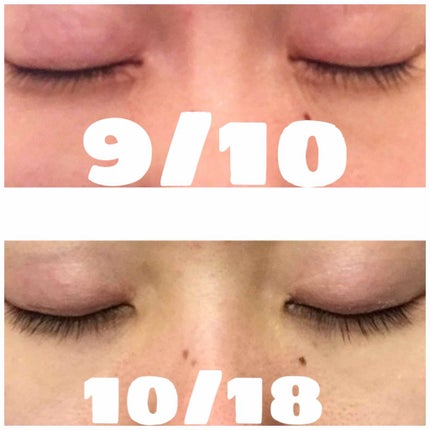 スカルプD ボーテ ピュアフリーアイラッシュセラム/アンファー(スカルプD)/まつげ美容液を使ったクチコミ(2枚目)