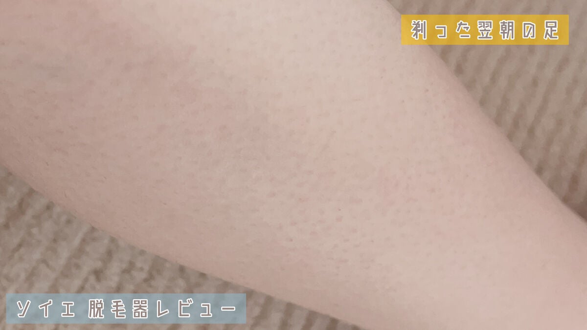 脱毛器 ソイエ ES-WS35 /Panasonic/家庭用脱毛器を使ったクチコミ(6枚目)