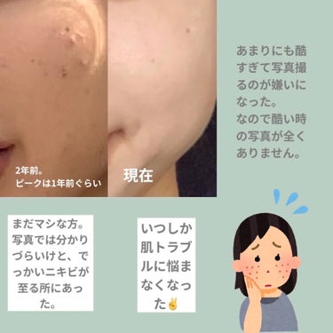 あずき on LIPS 「こんにちは。あずきです。本日は私のお肌を劇的に変えてくれたスキ..」（2枚目）