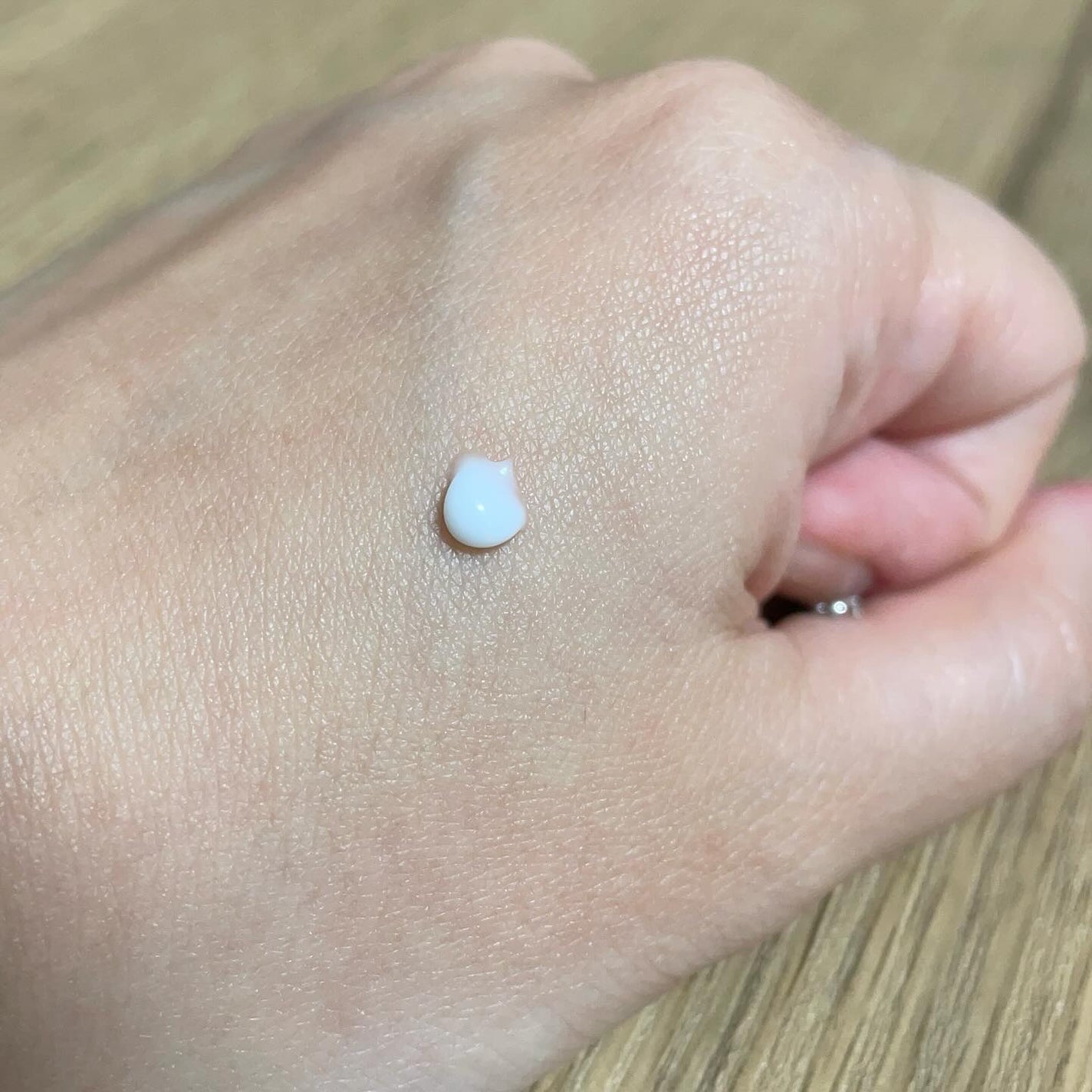 HiCA AZAリペアクリーム アゼライン酸10%/HiCA/フェイスクリームを使ったクチコミ(2枚目)