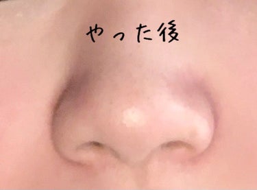 ぴくるす。 on LIPS 「皆さんはじめまして！ぴくるす。です！今回は、実際に私が毎日して..」（3枚目）