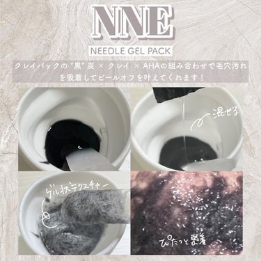 ニードル炭酸パック/NNE/洗い流すパック・マスクを使ったクチコミ（3枚目）