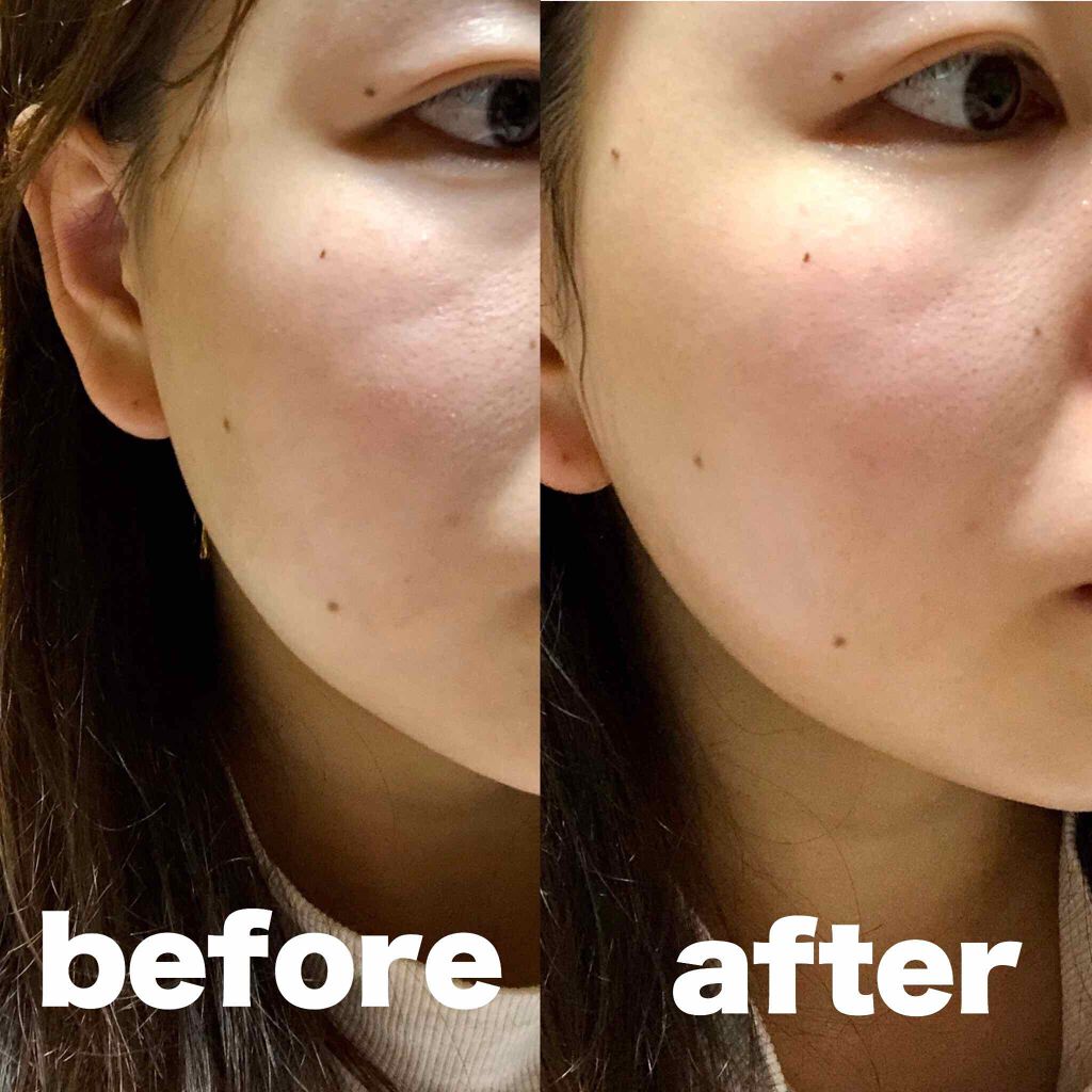 スーパーホワイト377VC/ドクターシーラボⓇ/美容液を使ったクチコミ(2枚目)