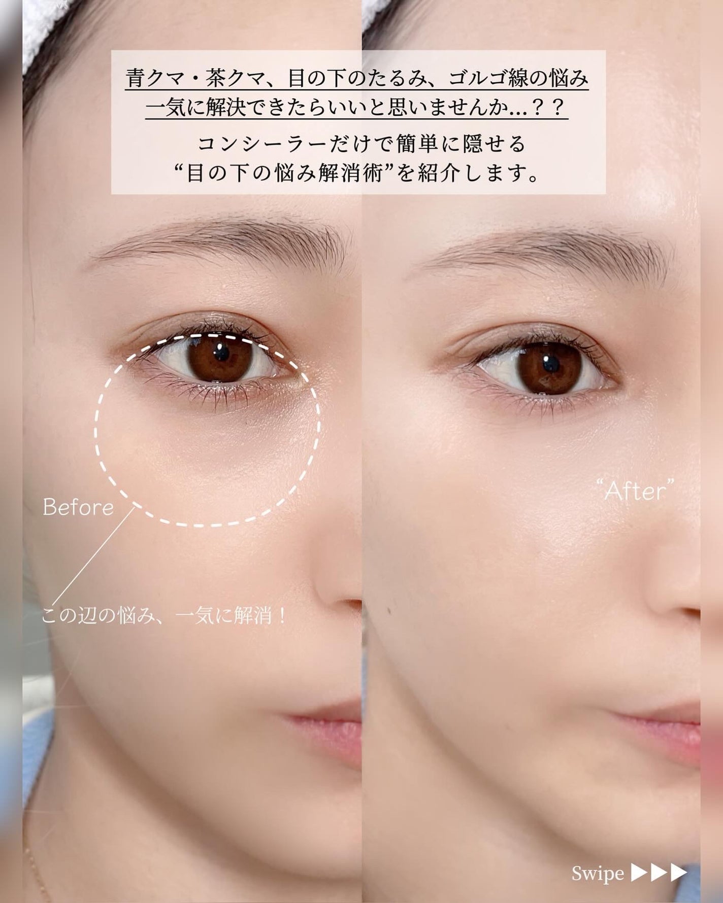 Karin.ðŠâªï¿€ã«ã©ã³ã³ã¬ãðïœLens Log  on LIPS ãæ©ã¿å¥è§£æ¶æ³âä¿åçâ//ç®å
ã®ã¯ããããã¿ã®æ©ã¿ãããèããŸ..ãïŒ2æç®ïŒ