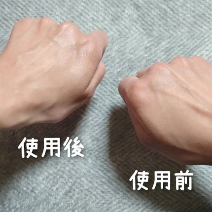 スキンエッセンス/Reductio/美容液を使ったクチコミ(5枚目)