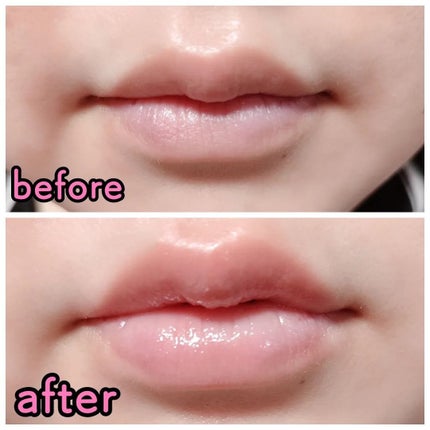 ドトムリッププラスプランパー/keybo/リッププランパーを使ったクチコミ(4枚目)