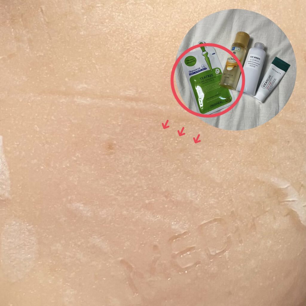 CICA ケアクリーム/BEAUSTA/フェイスクリームを使ったクチコミ（3枚目）