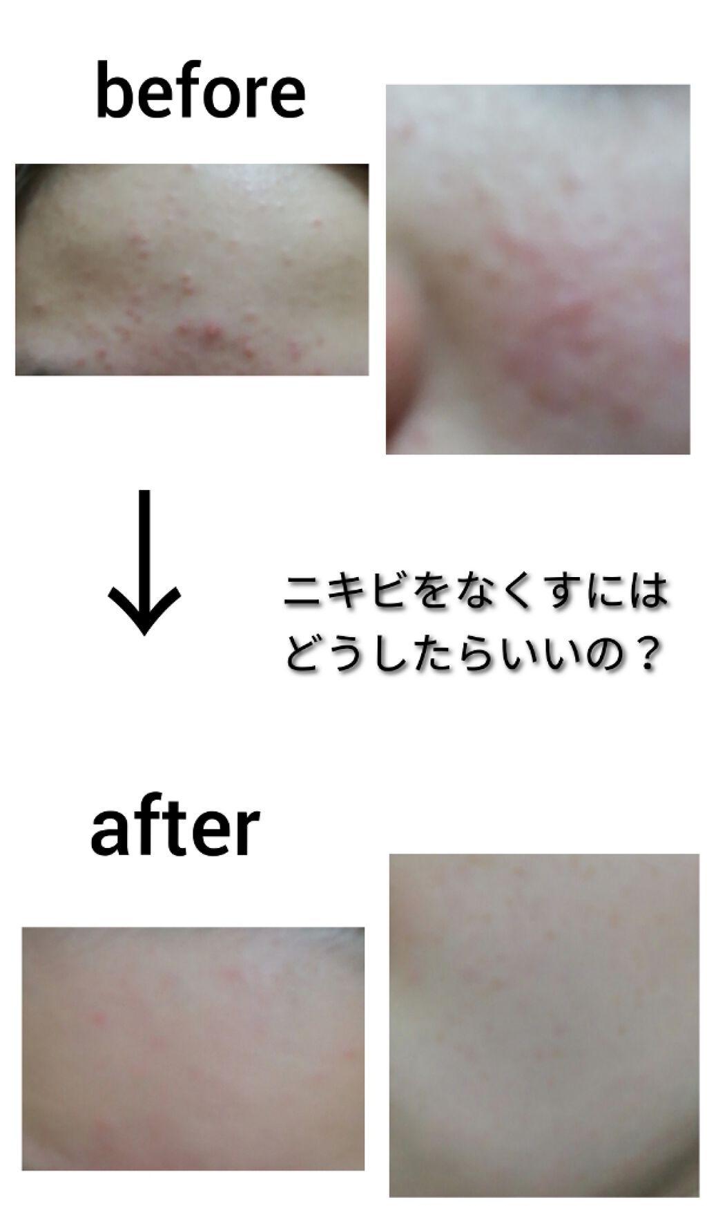 薬用洗顔フォーム/スキンライフ/洗顔フォームを使ったクチコミ（1枚目）