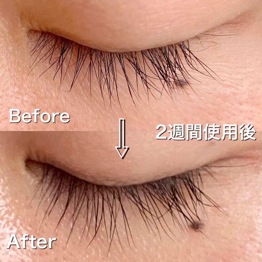 エグータム/アルマダスタイル/まつげ美容液を使ったクチコミ(2枚目)