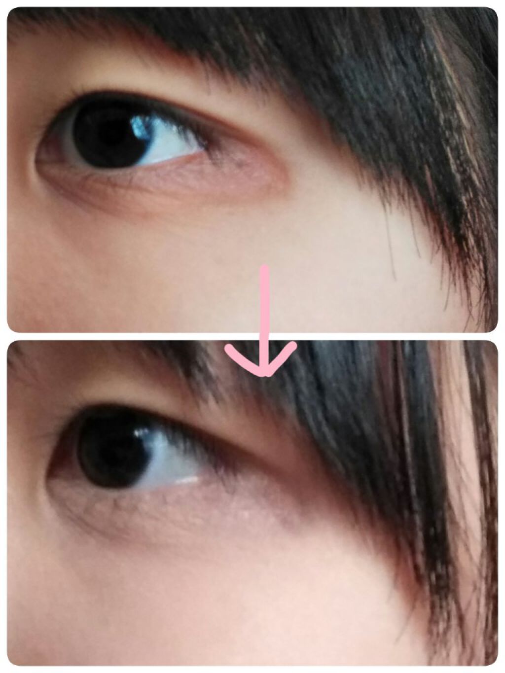 UR GLAM　CONCEALER PALETTE/U R GLAM/パレットコンシーラーを使ったクチコミ（2枚目）