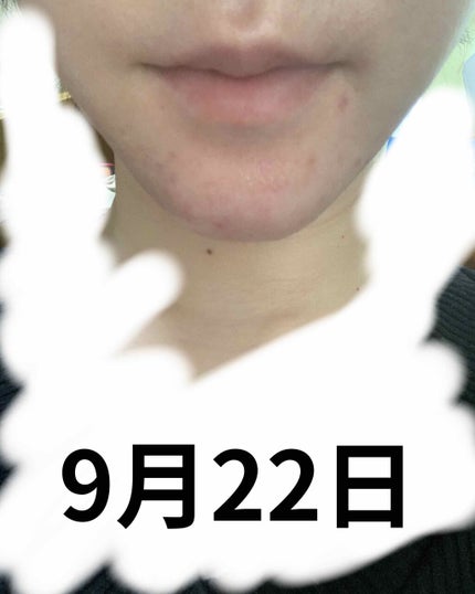 新エバユースB26 (医薬品)/エバユース/その他を使ったクチコミ(4枚目)