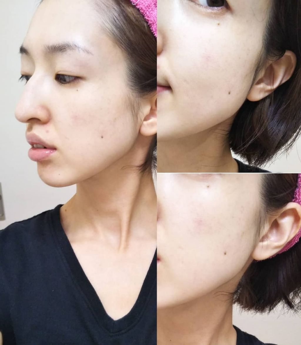 JUSO KURO SOAP/NAKUNA-RE/洗顔フォームを使ったクチコミ(4枚目)