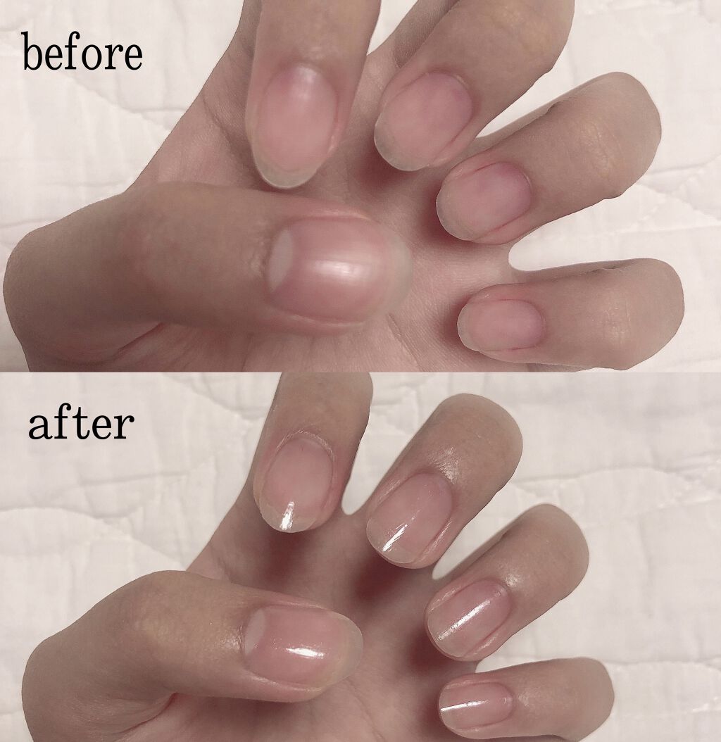 ネイルサポート ピンク/ネイルネイル/ネイルベースコートを使ったクチコミ（1枚目）