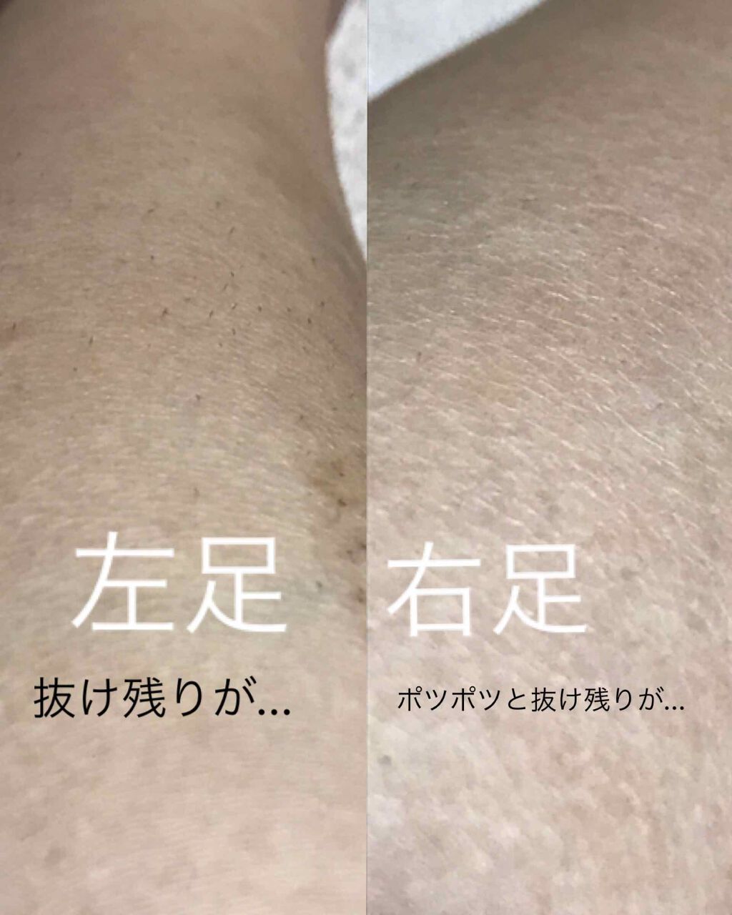 バスタイム除毛クリーム 敏感肌用/Veet/除毛クリームを使ったクチコミ（3枚目）