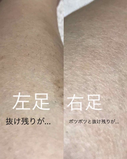 バスタイム除毛クリーム 敏感肌用/Veet/除毛クリームを使ったクチコミ(3枚目)