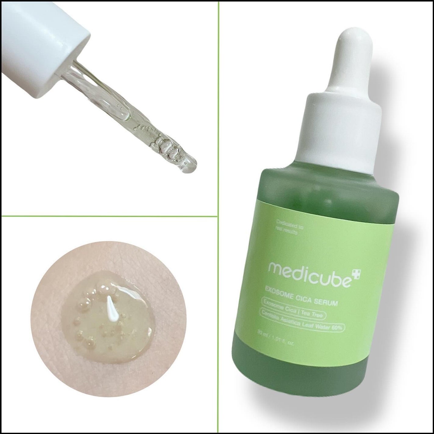 エクソソームシカセラム/MEDICUBE/美容液を使ったクチコミ(3枚目)