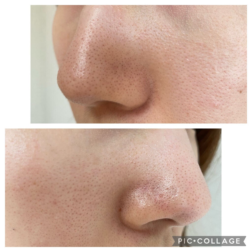 ノーモアブラックヘッド(ノーズピーリング)/One-day's you/スクラブ・ゴマージュを使ったクチコミ(2枚目)