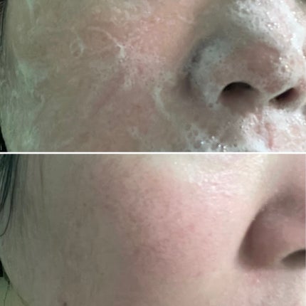 マイクロバイオーム酵素パウダークレンザー/Sunnicorn/洗顔パウダーを使ったクチコミ(4枚目)