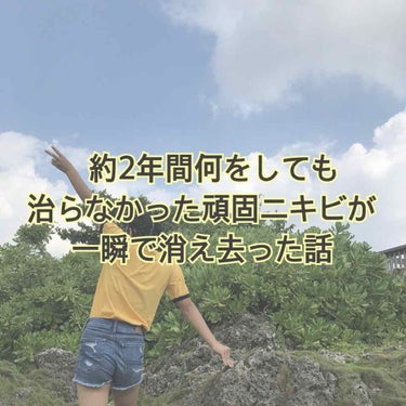 またまた久々投稿になってしまいました( '༥'  )
今回は私が約2年間悩み続けた頑固ニキビの撃退法についてお話しようと思いますッ👏👏👏


✽.｡.:*・ﾟ ✽.｡.:*・ﾟ ✽.｡.:*・ﾟ ✽.｡