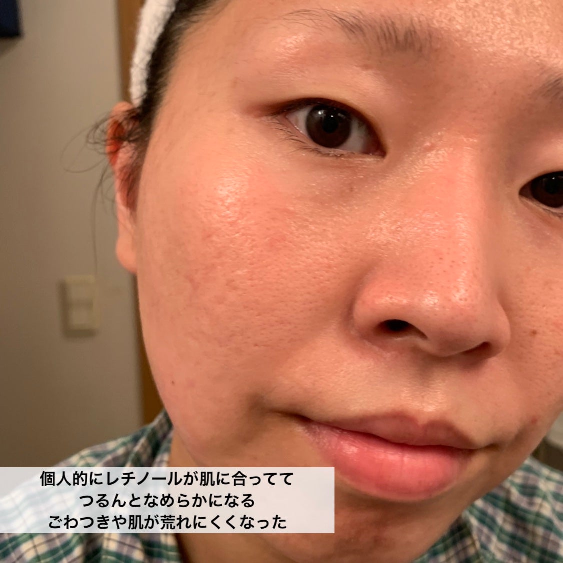 レチノール シカ リペア セラム/innisfree/美容液を使ったクチコミ(8枚目)