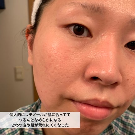 レチノール シカ リペア セラム/innisfree/美容液を使ったクチコミ(8枚目)