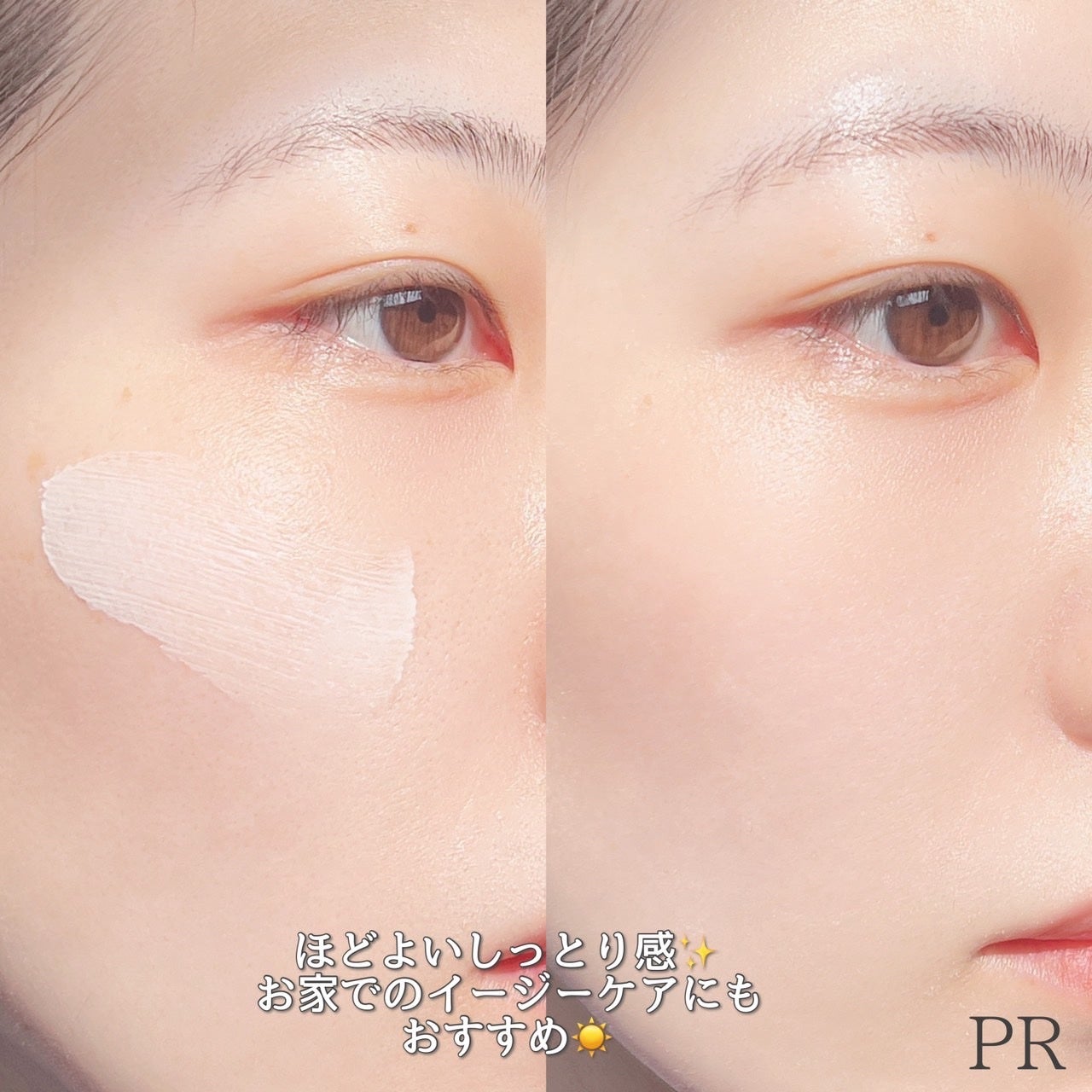 ããŒã¹ ã¯ãªã¢UVãããã¯ã¿ãŒ/ organic/æ¥çŒãæ¢ãã¯ãªãŒã ã䜿ã£ãã¯ãã³ãïŒ5æç®ïŒ