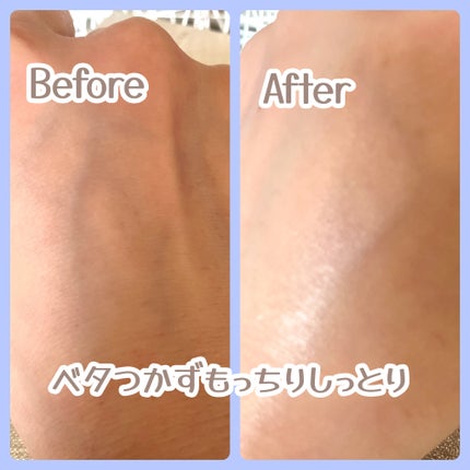 73シワクリーム/MAYBENA/フェイスクリームを使ったクチコミ(5枚目)