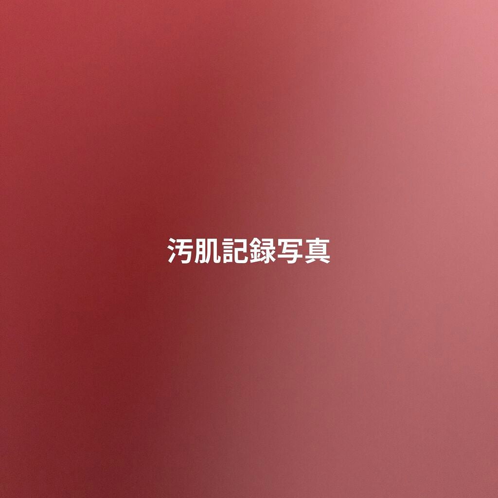 ベジータ on LIPS 「今週の肌 1.23ディフェリンゲル塗っても全然毛穴出てくれなく..」(1枚目)