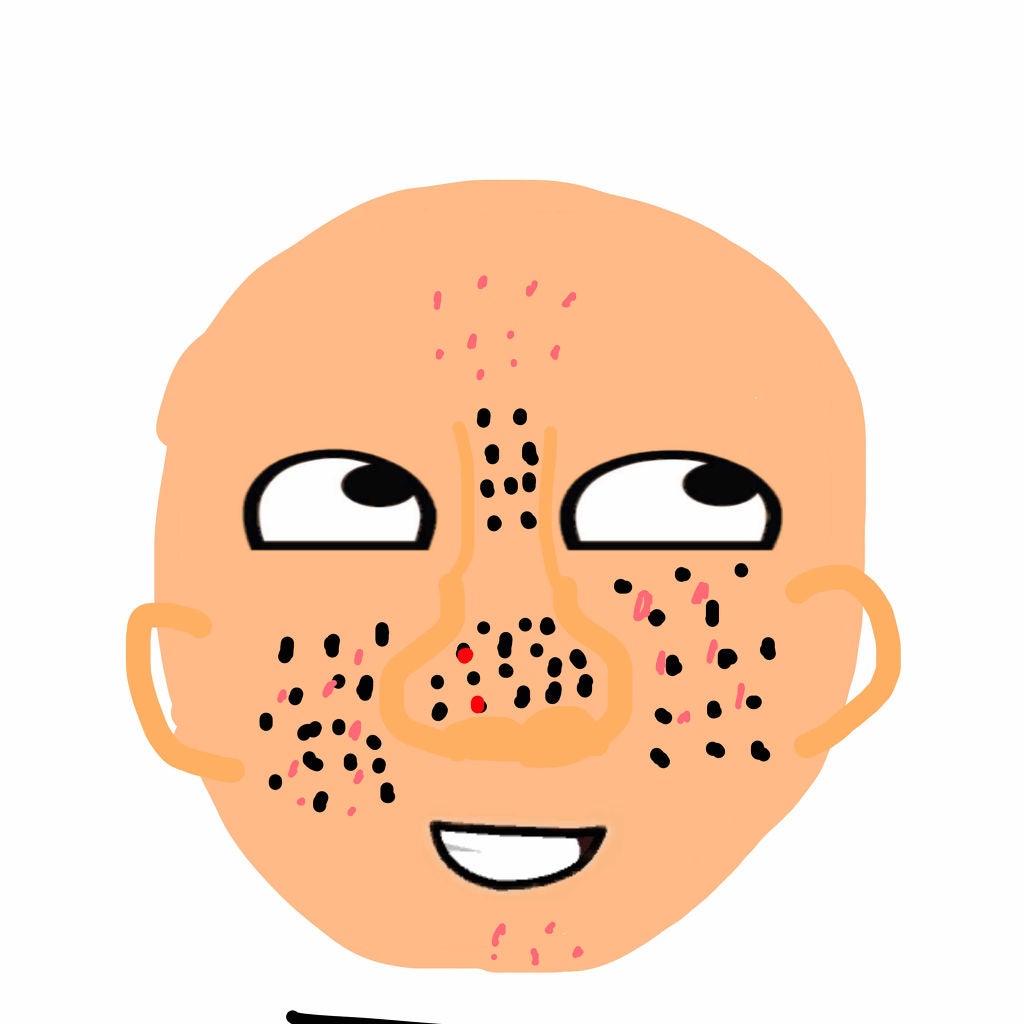 pink_make_yxe on LIPS 「すみません💦高校2年生です!肌で困っています…。うちの肌は乾..」(1枚目)