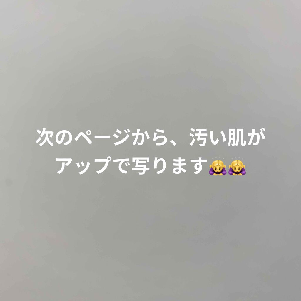 ハトムギ化粧水(ナチュリエ スキンコンディショナー R )/ナチュリエ/化粧水を使ったクチコミ（2枚目）