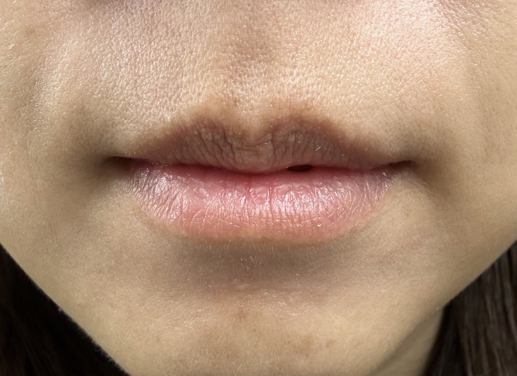 リップケア クリーム（美発色シリーズ） 美発色ピンク/キュレル/リップクリームを使ったクチコミ（1枚目）