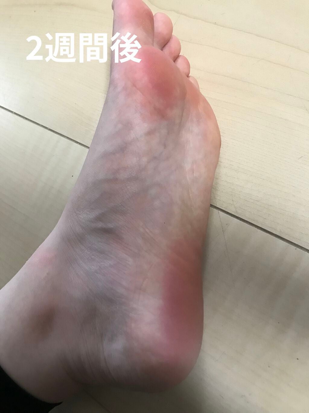 足裏ランラン エキスプレス/MYM/レッグ・フットケアを使ったクチコミ(4枚目)