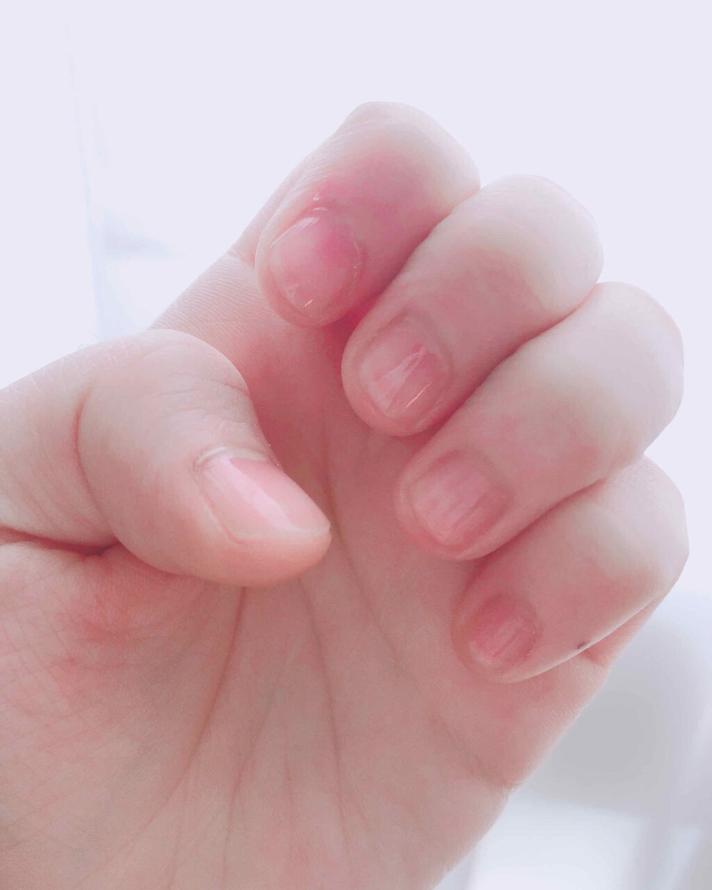 デイケアオイル/Dr.Nail/ネイルオイル・トリートメントを使ったクチコミ（3枚目）