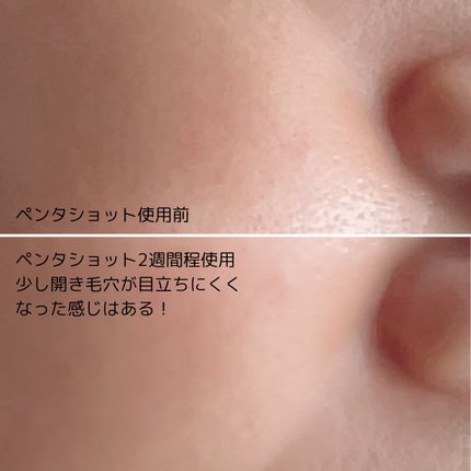 ポテンションポアタイトニングブーストセラム|CELORABY他、1 ポテンションポアタイトニングブーストセラム|CELORABY他、1