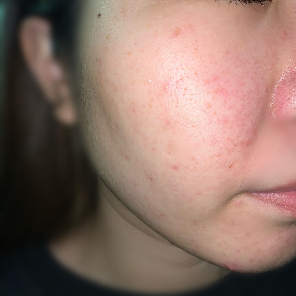 Oxy ディープウォッシュ/OXY (ロート製薬)/洗顔フォームを使ったクチコミ（3枚目）