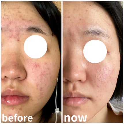 化粧水・敏感肌用・高保湿タイプ/無印良品/化粧水を使ったクチコミ(2枚目)