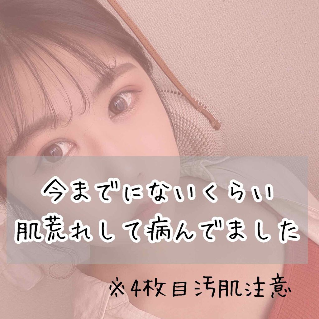 チョコラBBスパークリング/チョコラBB/美容ドリンクを使ったクチコミ(1枚目)