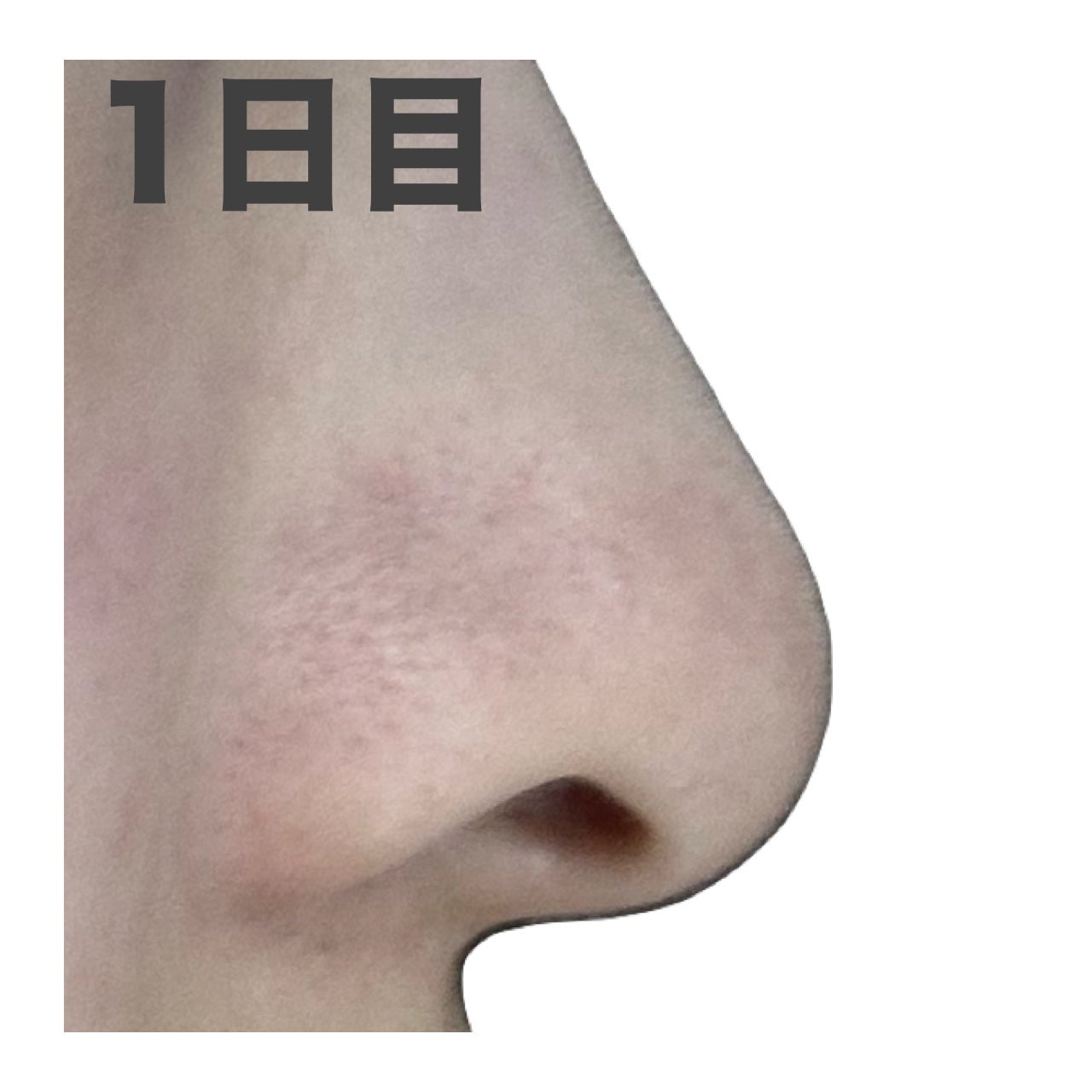 デュオ ザ クレンジングバーム ブラックリペア /DUO/クレンジングバームを使ったクチコミ(6枚目)