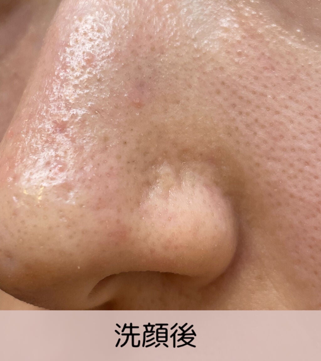 ホワイト もこもこ白泡マスク/リッツ/洗い流すパック・マスクを使ったクチコミ(5枚目)